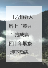 六旬老人唇上“黄豆”拖成癌 四十年烟瘾埋下隐患